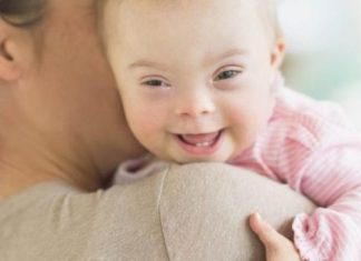 Bệnh Down có di truyền không? Bệnh Down có di truyền không?