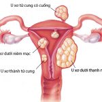 Các bệnh phụ nữ sau khi sinh thường xuyên gặp, các mẹ cần lưu ý