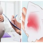 Bầu đau bụng kèm ra huyết âm đạo: mức nào là khẩn cấp?